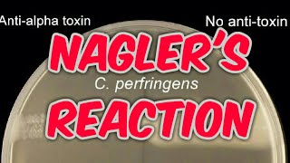 Naglers reaction clostridium perfringens in hindi [upl. by Ahsoj]