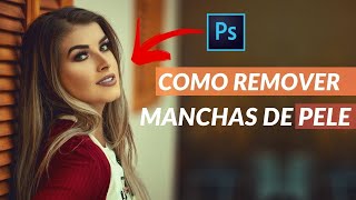 COMO REMOVER MANCHAS DA PELE USANDO PHOTOSHOP [upl. by Chang]