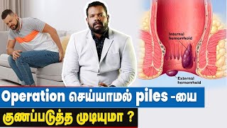 மூல நோய் காரணமும் தீர்வும்  Piles Treatment in Tamil  Precautions for Piles  Types of Piles [upl. by Steffane]