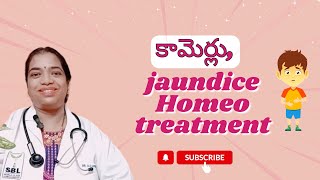 కామెర్లు jaundiceHomeo treatment SudharamanHomeoClinic [upl. by Maice]