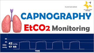 Capnography  ETCO2 Monitoring [upl. by Amitarp]