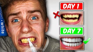 TEETH WHITENING PENS Do They Work 7 day challenge [upl. by Modeerf]