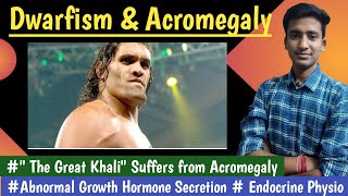 Acromegaly amp Dwarfism amp Gigantism  Growth HormoneEndocrine Physiology  in hindi Ashish [upl. by Redle]