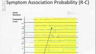 Acoustic Cough Reflux Associations in Chronic Cough [upl. by Alejo]