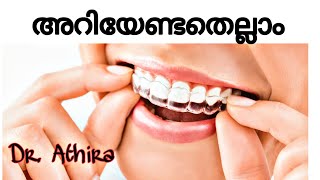 clear aligners malayalam  aligners  invisalign  invisalign aligners  pallil kambi idunnath [upl. by Ailaht]