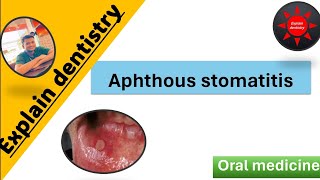 Aphthous stomatitis Lecture  Introduction  classification clinical features etiology Management [upl. by Burl642]