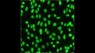 IIFANA STAINING PATTERNS INTERPRETATION  ANTINUCLEAR ANTIBODIES TESTING OF AUTOIMMUNE DISORDERS [upl. by Aleda]