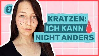 Skinpicking Krankhaft Pickel ausdrücken🩸😣  Auf Klo [upl. by Ahsenor]