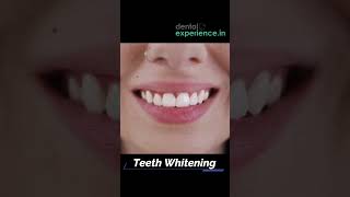 Tooth Cleaning  Teeth Scaling I stain or Tartar Removal cost  Dentalexperiencein [upl. by Hynes]