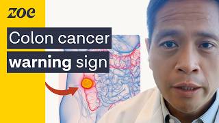 Harvard Doctor Why young people are getting colon cancer  Dr Andy Chan [upl. by Larkin]