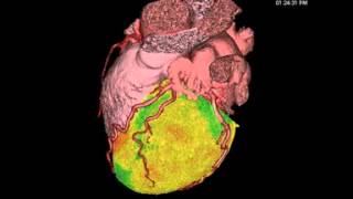 Preclinical PETCT Heart Scan Video [upl. by Sinnej]