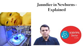 Jaundice in Newborn Babies  Explained [upl. by Cecelia]