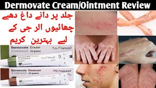 Dermovate Cream Uses Dermovate ointment Uses Clobetasol Cream Uses and Side effects in Urdu Hindi [upl. by Atekan95]