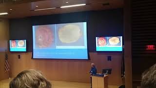 2018 Patient Summit Dr Frits van Rhee Presents on Castleman Disease [upl. by Letha796]