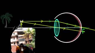 Human eye accommodation and near point Hindi  Human eye  Physics  Khan Academy [upl. by Lexie]