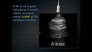 Evaluasi Cepat Menggunakan USG  Fever Eval Using Ultrasound [upl. by Yatnahc]