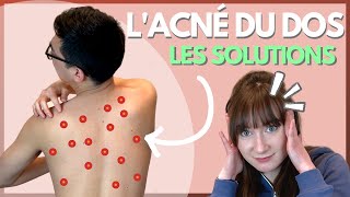 Combattre lacné du dos en 4 minutes 💪 acné [upl. by Farr]