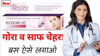 Elosone ht Skin Cream Kaise Use kare  Elosone ht skin cream side effects [upl. by Egide302]