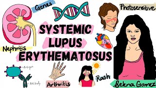 Systemic Lupus Erythematosus  SLE  Pathophysiology Diagnosis Treatment  Rheumatology [upl. by Ruthann]