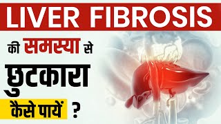 Liver Fibrosis क्या है   What is liver fibrosis  लिवर फाइब्रोसिस से छुटकारा कैसे पायें [upl. by Raseac433]