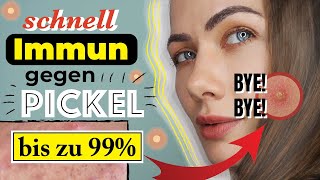 ➡️ So SCHÜTZE ich MICH gegen PICKEL einfacher TRICK💡  PICKEL loswerden 🚫 [upl. by Notlimah341]