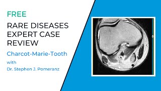 Rare Diseases Expert Case Review Rare MSK Diagnosis CharcotMarieTooth [upl. by Weinman]