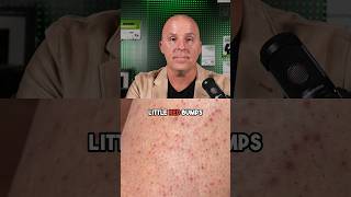 Decoding Red Bumps Behind the Arms Understanding and Managing Keratosis Pilaris [upl. by Aindrea]