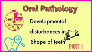 DEVELOPMENTAL DISTURBANCES IN TEETH  SHAPE OF TEETH  Oral Pathology [upl. by Minier]