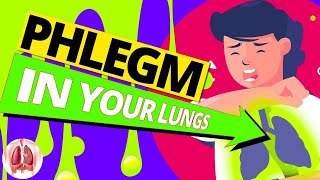 Top 10 Ways to Get Rid of Constant Mucus and Phlegm in Your Throat [upl. by Swart]