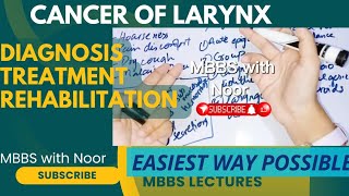 CANCER LARYNX part3  diagnosis  treatment  doctorsplaceacademy [upl. by Assirem]