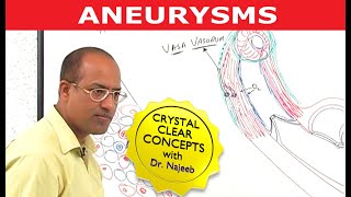 Aneurysms  Causes and Symptoms  Cardiology [upl. by Milo]