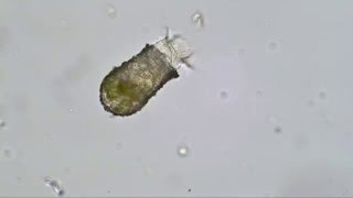 Codonella cratera tintinnid ciliate [upl. by Adnilemreh]