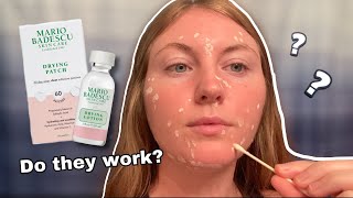 TRYING THE Mario Badescu DRYING LOTION  PATCHES  1 week Review amp Results [upl. by Karita383]