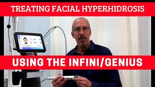 Treating Facial Hyperhidrosis Using The InfiniGeniusRF Microneedling With Long Term Results [upl. by Amaryllis979]