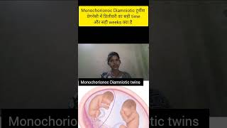 monochorionoc Diamniotic twins pregnancy me delivery ka sahi time kya hota h shortstwinsdelivery [upl. by Emmalynn]