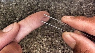 How to remove a splinter [upl. by Elleyoj695]