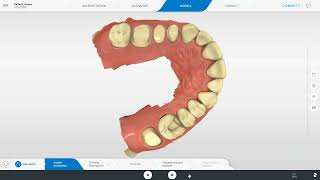 Connect 50 Workflow von der Anlage eines Falls bis zur Übermittlung mit CEREC Primescan [upl. by Carmelia]