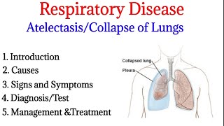 Atelectasis  Introduction causes signs ampsymptoms diagnosis and treatment  Respiratory disease [upl. by Daniyal]