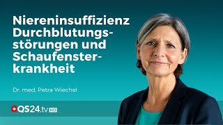 Niereninsuffizienz Durchblutungsstörungen und Schaufensterkrankheit  Dr med Petra Wiechel  QS24 [upl. by Aicirtan]