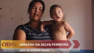 Mãe conta as dificuldades para tratar filho com fissura labiopalatal [upl. by Reivaj]