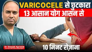 Cure Varicocele With Yoga and Exercises at Home  Varicocele Natural Treatment [upl. by Aicekan]