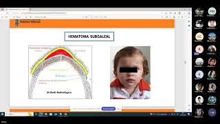 10 EMERGENCIAS NEONATALES [upl. by Mazurek]