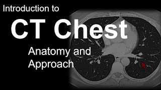 Introduction to CT Chest  Anatomy and Approach [upl. by Edette159]