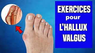 HALLUX VALGUS  TRAITEMENT ET EXERCICES KINÉ [upl. by Yobybab370]