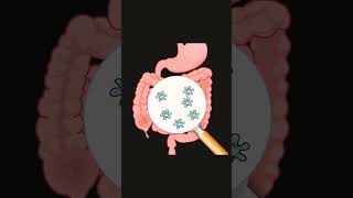 Correct your gut dysbiosis by following this step 👆🏻guthealth youtubeshorts [upl. by Byler]