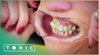 Woman Glues Her Teeth Back In Place To Avoid The Dentist  The Truth About Your Teeth  Tonic [upl. by Aicilehp]