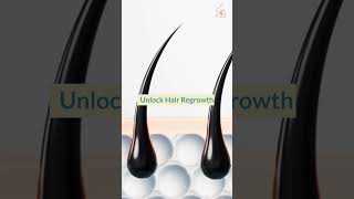 Transform Your Hair Top 4 Castor Oil Hair Growth Benefits shorts [upl. by Ihtraa579]