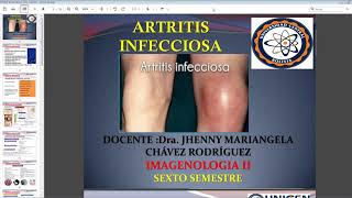 Artritis Infecciosa Etiología Diagnóstico y Tratamiento [upl. by Dunton]