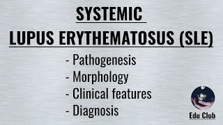 Systemic Lupus Erythematosus SLE  Pathogenesis  Morphology  Clinical  Diagnosis [upl. by Newcomer]