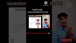 💉नशबंदीvasectomy medical procedureanatomypopularmosttrendingwowviralvideo [upl. by Margi770]